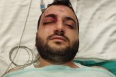 Hastanede arbede:3 doktor birleşerek 1 doktoru dövdü